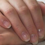 A Natural Cure for Brittle Nails